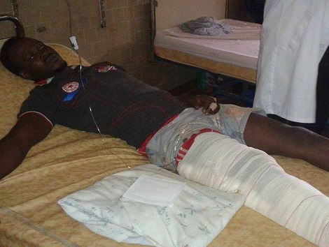 Un blessé alité à l'hôpital Ignace Deen         Photo-Africaguinee.com